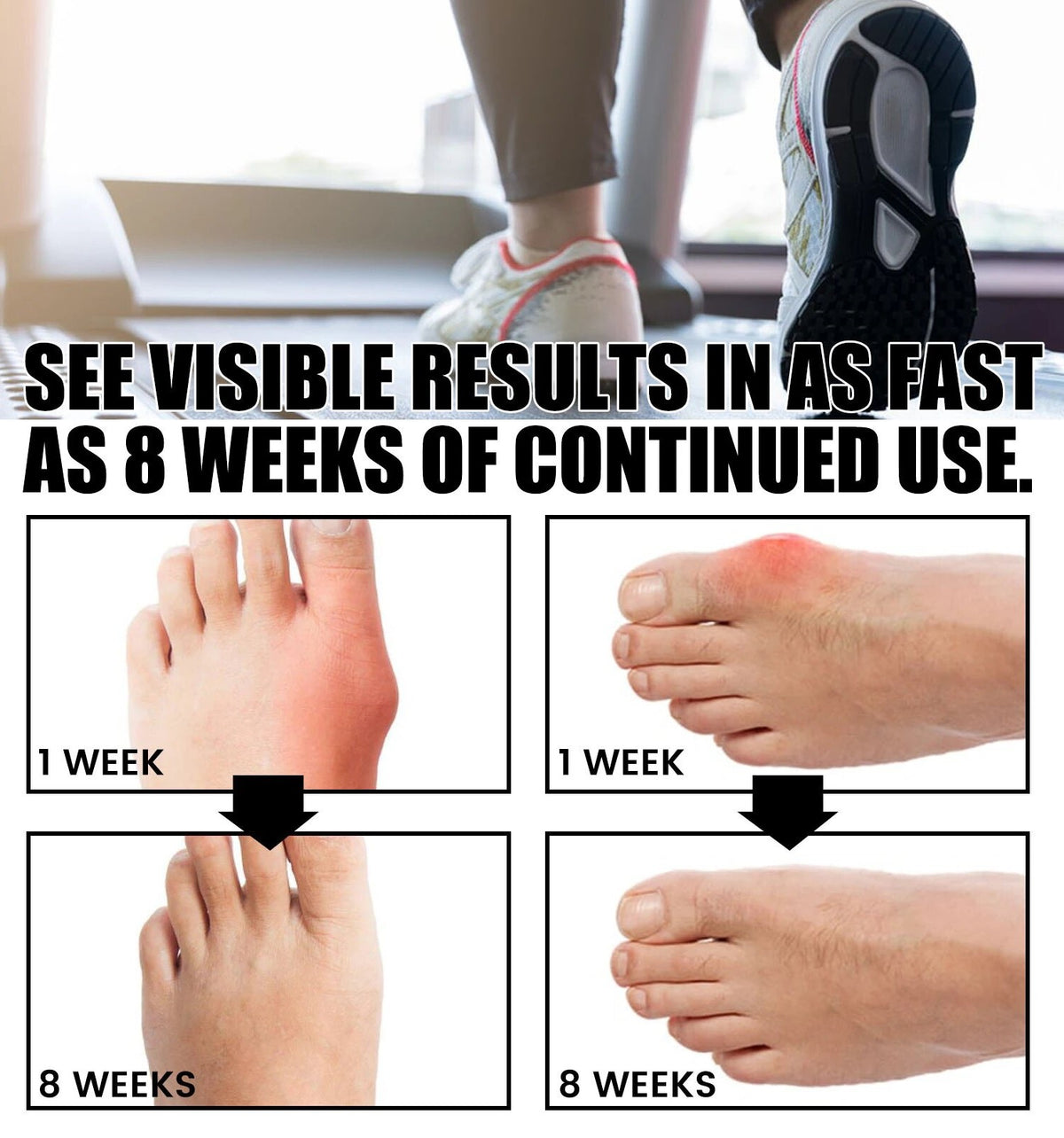 Orthoes™ Bunion Relief Socks
