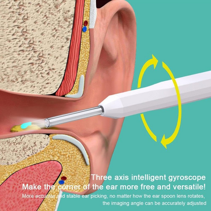 Wireless Ear Cleaner – Rechargeable Otoscope with Camera & LED Light
