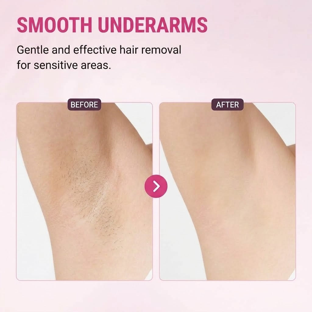 Women's Rechargeable Epilator – USB Electric Hair Remover with Trimmer