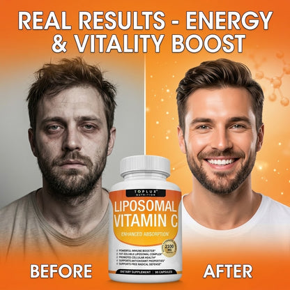 2100mg Liposomal Vitamin C Capsules Antioxidant Supplement