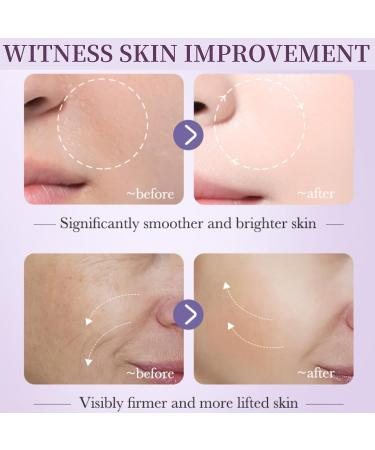 Retinol Anti-Aging Serum – Moisturizing Deep Nourishing Antioxidant Skin Care