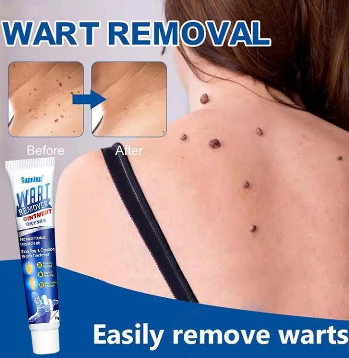 Wart Instant Blemish Cream