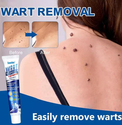 Wart Instant Blemish Cream