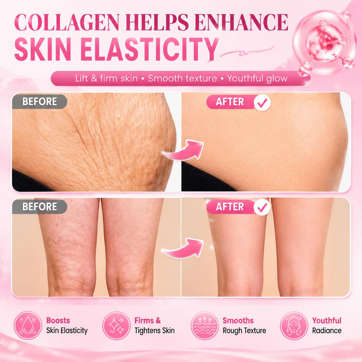 ADEUS Intensive Firming Cellulite & Stretch Mark Cream