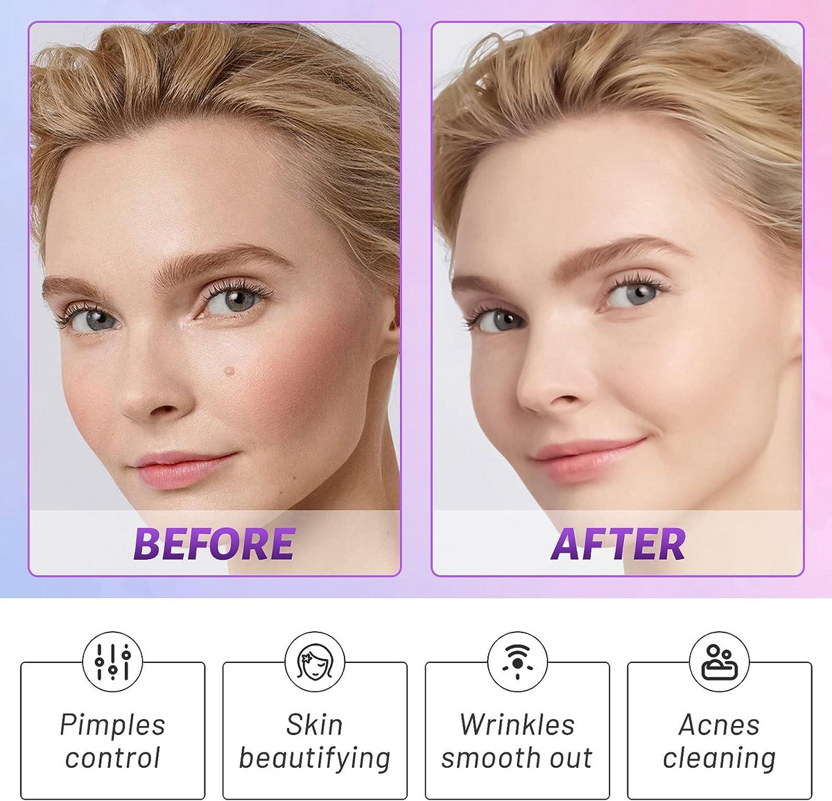 Portable High Frequency Facial Electric Skin Care & Scalp Massage