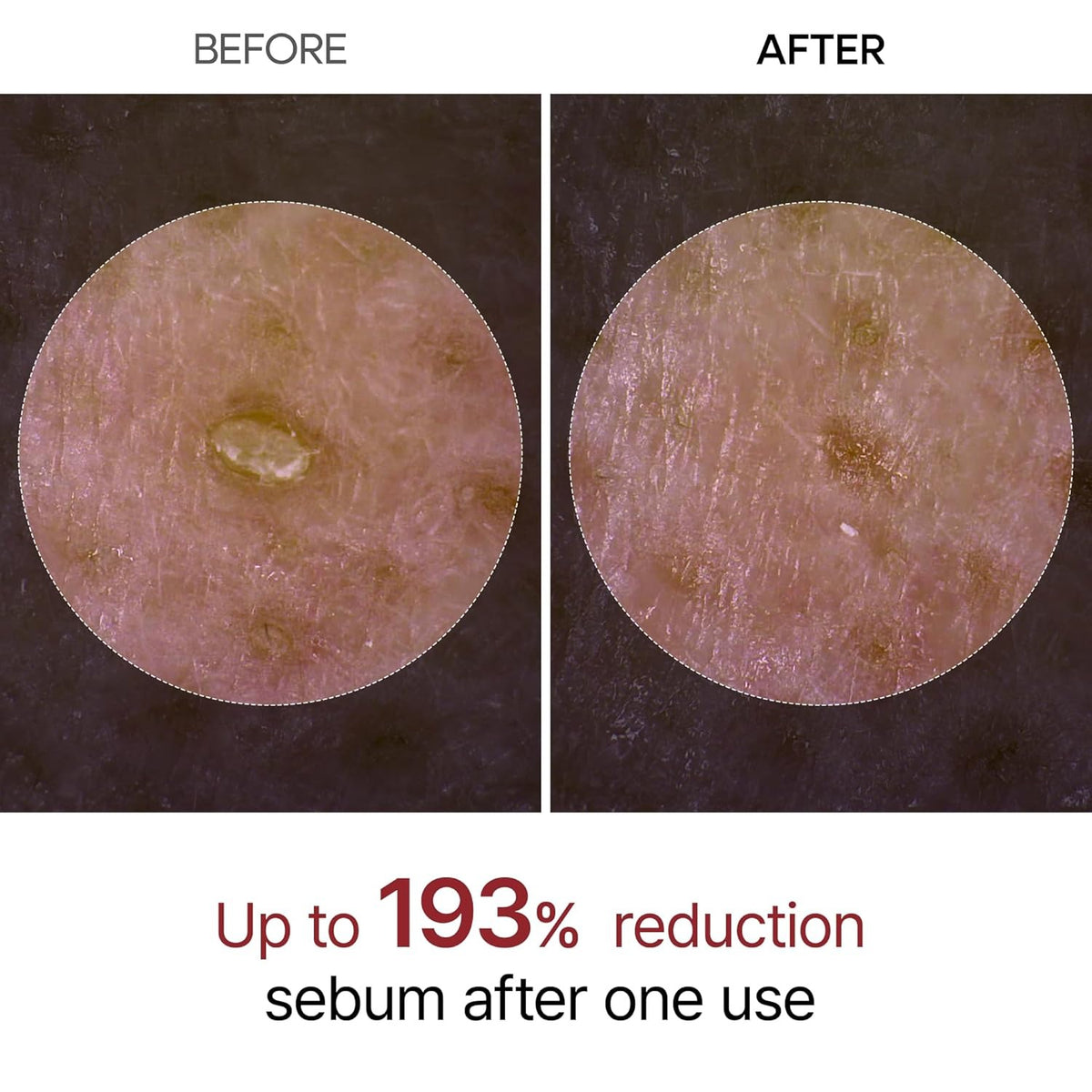 Peel Shot — Kojic + Turmeric Body Peel Spray