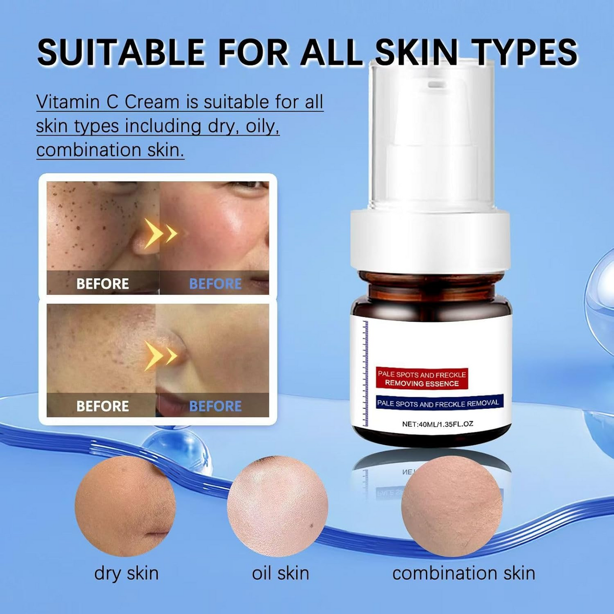 Dark Spot Corrector Serum – Advanced Brightening for Face & Body