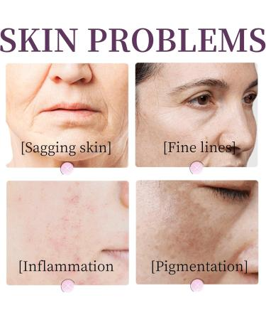 Retinol Anti-Aging Serum – Moisturizing Deep Nourishing Antioxidant Skin Care