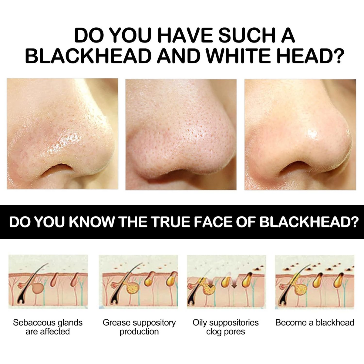 Peel Off Blackhead Remover Mask – Deep Clean & Smooth Pore Care
