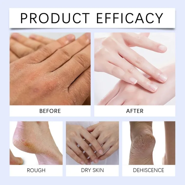 Cracked Heel & Hand Repair Cream – Intensive Moisturizing Foot & Hand Care for Dry Skin