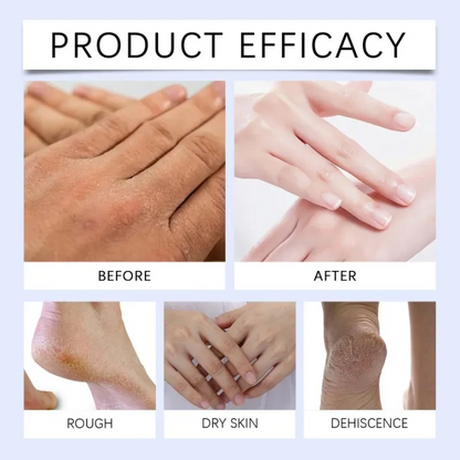 Cracked Heel & Hand Repair Cream – Intensive Moisturizing Foot & Hand Care for Dry Skin