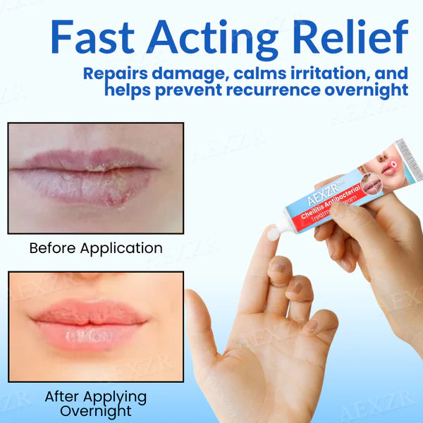 AEXZR™ Cheilitis Antibacterial Treatment Cream