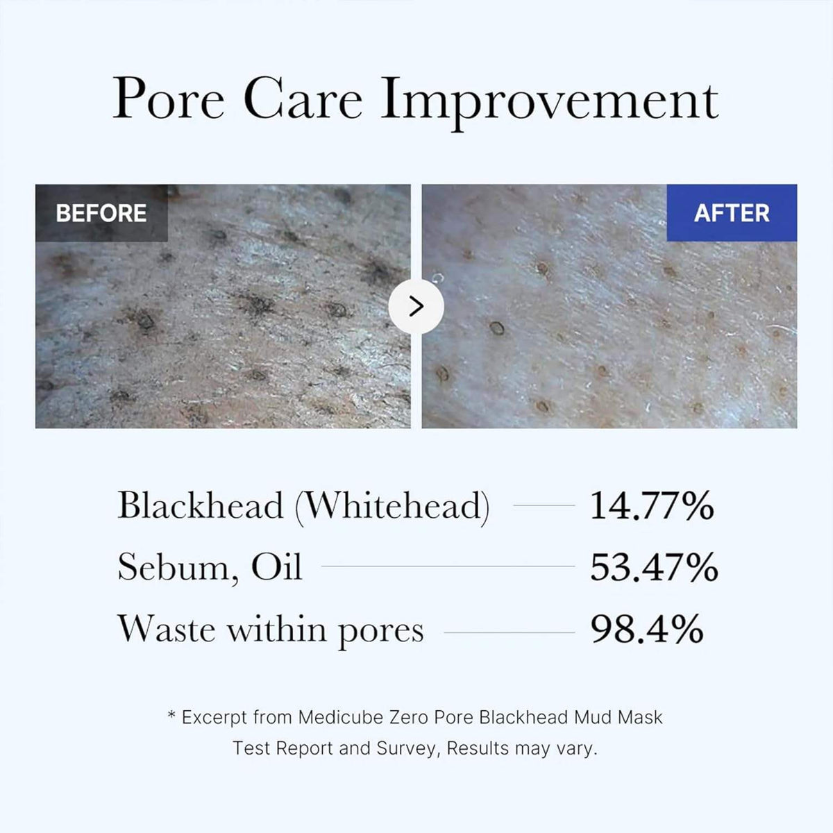 Medicube Zero Pore Blackhead Mud Mask – Deep Cleanse & Pore Care 100g