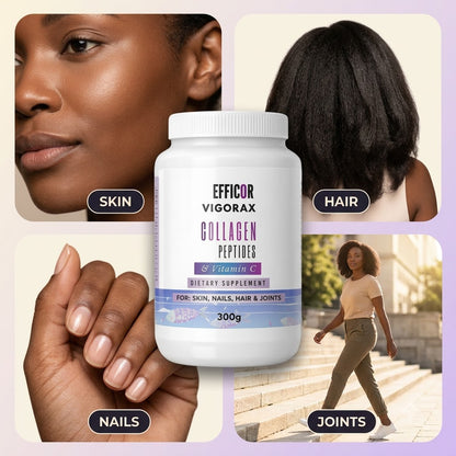 Collagen Peptides & Vitamin C – 300g Marine Collagen Powder for Skin, Nails, Hair & Joints