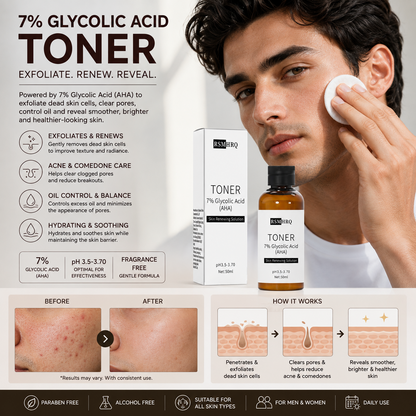 7% Glycolic Acid Acne Toner – Exfoliating, Pore-Clearing & Oil-Control Face Treatment