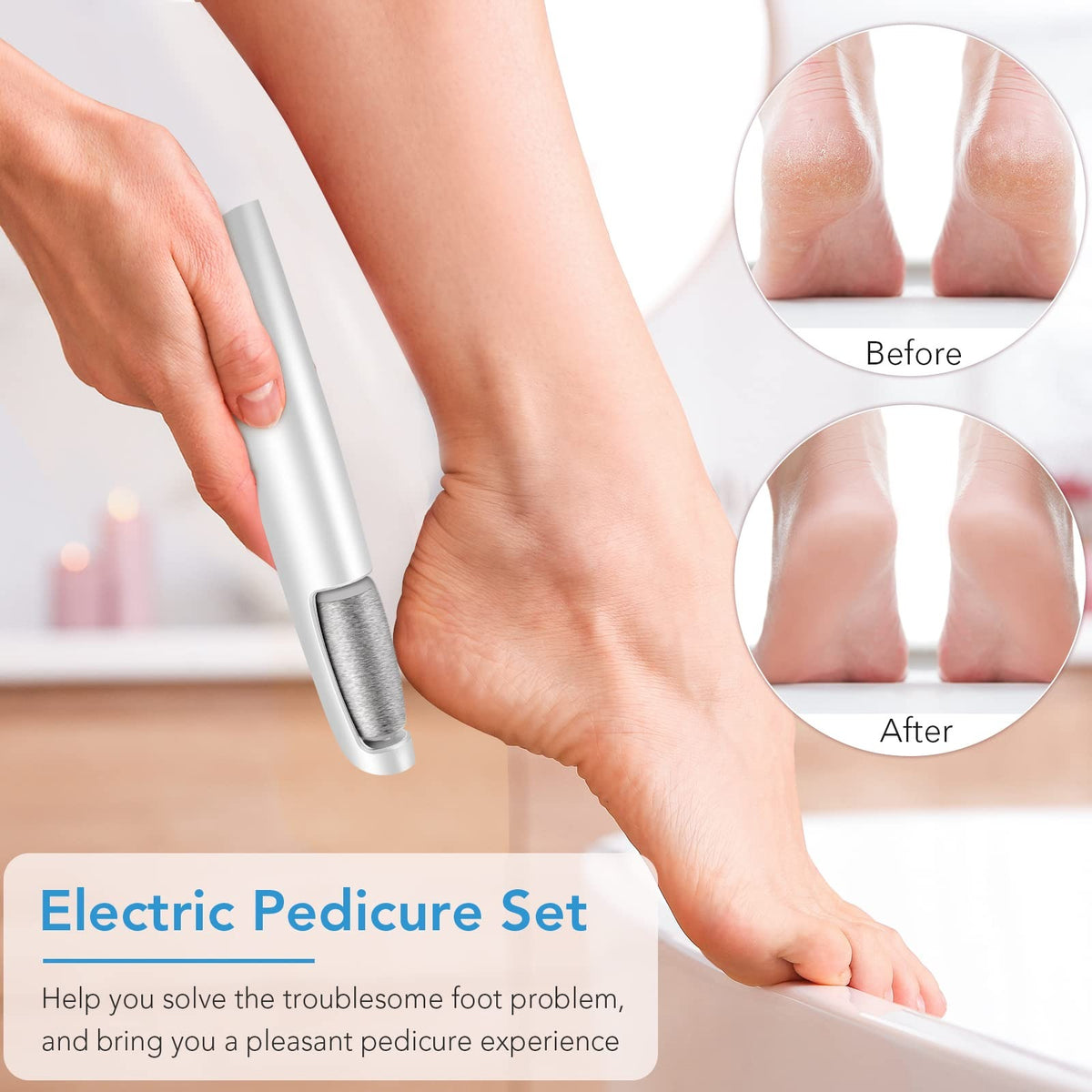 Rechargeable Electric Callus Remover