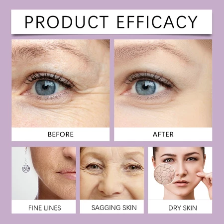 Retinol Anti-Aging Serum – Moisturizing Deep Nourishing Antioxidant Skin Care