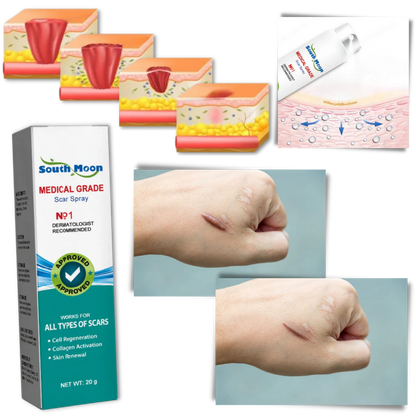 Advanced Scar Removal Spray