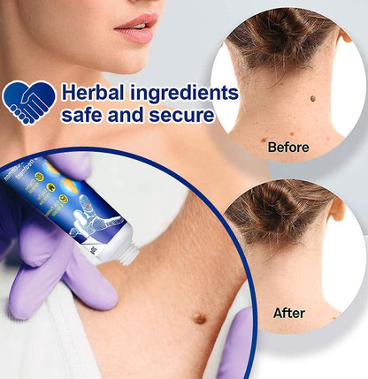 Wart Instant Blémish Cream